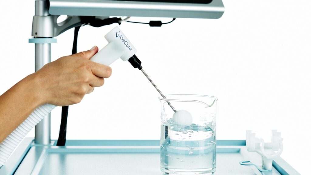 Israeli device freezes malignant liver and kidney tumors